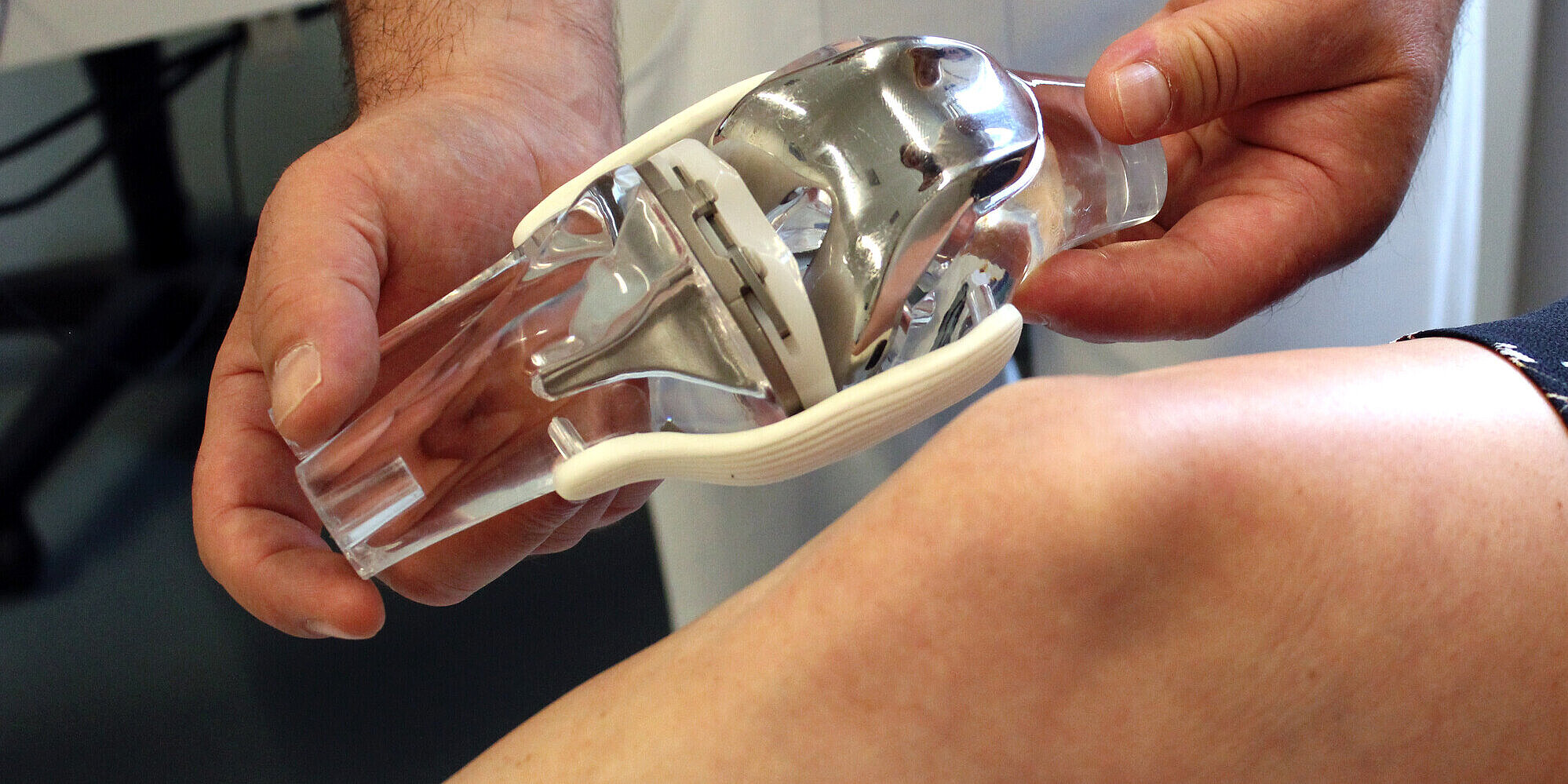 Ein Arzt hält eine Knieprothese neben das Knie eines Patienten.