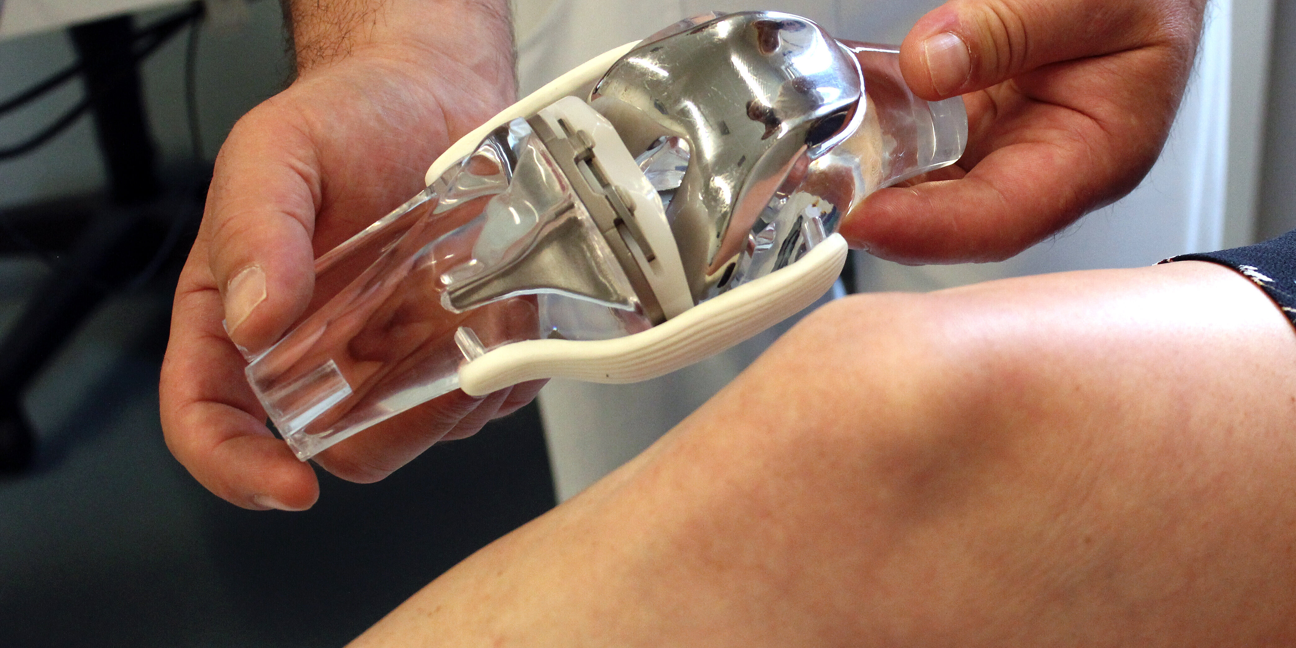 Eine Hand hält ein Modell eines künstlichen Kniegelenks neben das Knie einer Patientin.