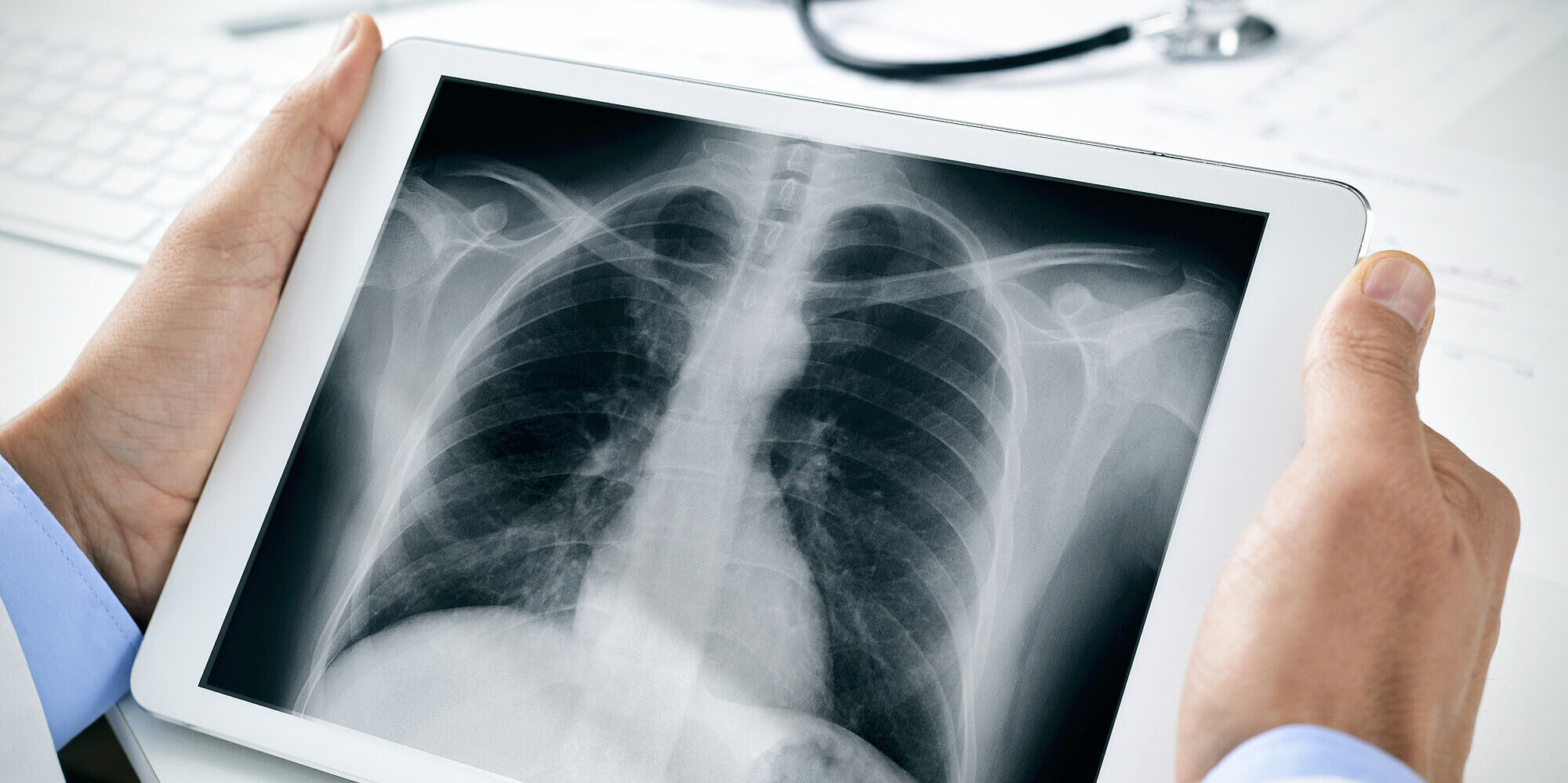 Teleradiologie: Radiologische Befunde bequem austauschen Röntgenbild auf Tablet