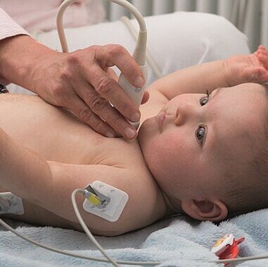 Kinderkardiologie: Umfassende Diagnostik und Betreuung bei Herzerkrankungen Ärztin hört mit Stethoskop die Herztöne eines Babys ab.