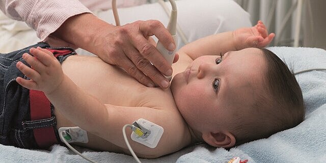 Kinderkardiologie: Umfassende Diagnostik und Betreuung bei Herzerkrankungen Ärztin hört mit Stethoskop die Herztöne eines Babys ab.