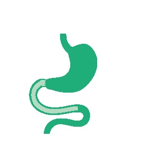 Dünndarmschutzhülle (EndoBarrier)